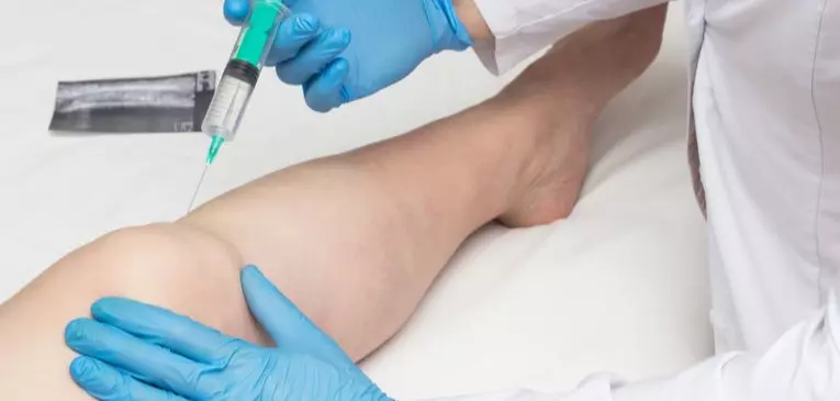 FISIOTERAPIA INVASIVA NO CONTROLE DA DOR E INFLAMAÇÃO FISIOTERAPIA INVASIVA NO CONTROLE DA DOR E INFLAMAÇÃO